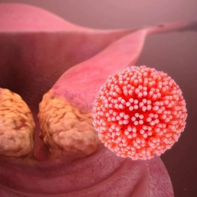 破局宫颈癌免疫治疗耐药！Mol Cancer（IF:33)｜复旦大学华克勤/邱君君：为克服免疫治疗耐