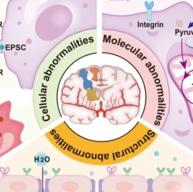 追踪癌细胞的分子足迹！Biomaterials｜复旦大学李聪：构建定位脑胶质瘤浸润边界影像探针，追踪