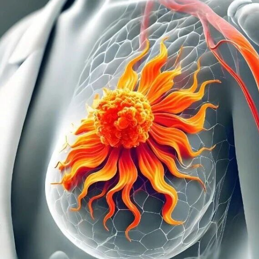 乳腺癌新辅助治疗“新星”！JCO（IF:41)｜复旦大学邵志敏：发布国产新型抗癌药临床试验获重大突破