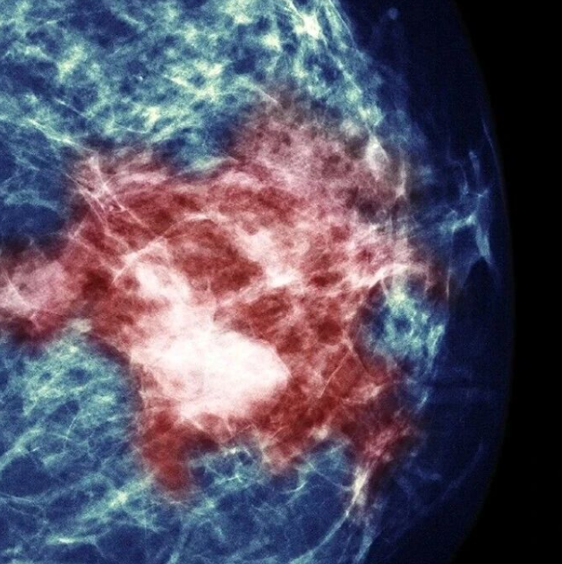 AI从辅助到决策的跃迁！Cancer Cell（IF:44)｜复旦大学邵志敏/江一舟/王中华/范蕾：