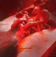 心血管高危个体识别新工具！Cardiovasc Diabetol｜复旦大学余勇夫/秦国友：构建面向M