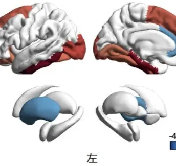 AD药物真实世界研究！Brain｜复旦大学郁金泰/崔梅/赵倩华：中国首个仑卡奈单抗治疗阿尔茨海默病安