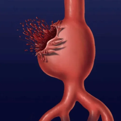 心血管研究新进展！Nature系列｜复旦大学高翔：合作揭示钙通道阻滞剂类降压药增加主动脉瘤和夹层风险