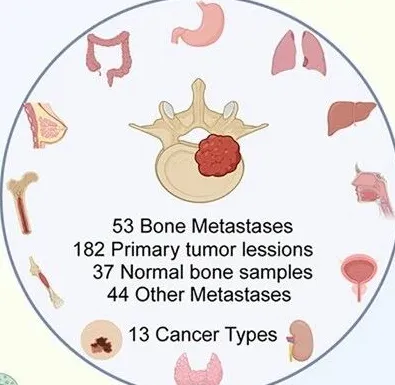 构建全球最大-13癌种骨转移单细胞图谱！Cell系列｜复旦大学严望军：为领域提供高价值基准图谱与对比