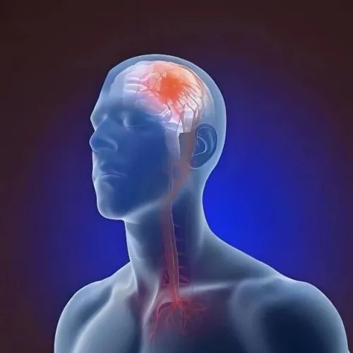 血压管理新范式！Lancet系列（IF:45)｜复旦大学克雷格·安德森/宋莉莉：梳理全球数十年程碑式