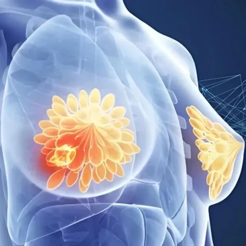 “最毒乳腺癌”新靶点！Cancer Cell（IF:44)｜复旦大学王红霞/陶中华/曹依群：揭示不靠