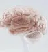脑病研究新发现！Brain｜复旦大学禹永春/刘琳云：利用雪貂模型揭示罕见脑发育疾病致病机制