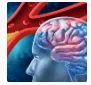发现高风险患者的“影像学指标”！Neurotherapeutics｜复旦大学程忻：研究为大血管闭塞所