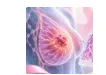 乳腺外科“精准”治疗新方向！BJC｜复旦大学柳光宇/邬思雨：探索二次空芯针穿刺指导乳腺癌腋窝手术降阶