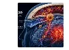 免疫细胞入脑的“关口”！Brain｜复旦大学许树茂：解读卒中炎症新机制，肥大细胞如何把守颅骨-硬脑膜